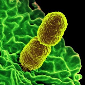 توصف مقاومة البكتيريا للمضادات
الحيوية بالتهديد الأكبر للبشرية